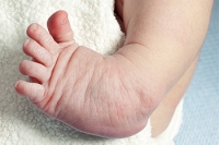 When Does Clubfoot Develop?