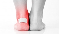 Possible Causes of Blisters