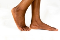 Flat Feet Are Not Always a Problem