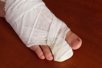 Managing a Broken Toe