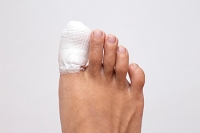 Is This a Toe Fracture?