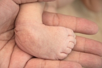 Symptoms and Causes of Clubfoot
